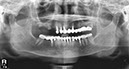%_tempFileNameImplant%2024e1%