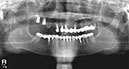 %_tempFileNameImplant%2024e2%