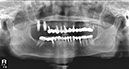 %_tempFileNameImplant%2024e3%