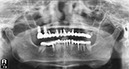 %_tempFileNameImplant%2024e4%