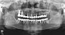 %_tempFileNameImplant%2024e5%