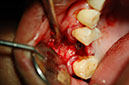 %_tempFileNameImplant%2025b%