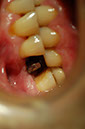 %_tempFileNameImplant%2025c%