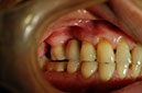%_tempFileNameImplant%2025d1%