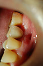 %_tempFileNameImplant%2025d2%