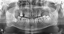 %_tempFileNameImplant%2025e1%