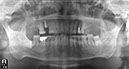 %_tempFileNameImplant%2025e2%