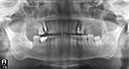 %_tempFileNameImplant%2025e3%
