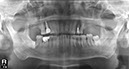 %_tempFileNameImplant%2025e4%