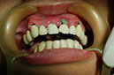 %_tempFileNameImplant%2026a1%