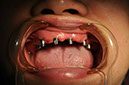 %_tempFileNameImplant%2026b5%