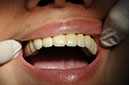 %_tempFileNameImplant%2026c%