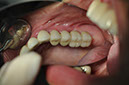 %_tempFileNameImplant%2026d%