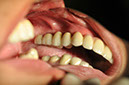 %_tempFileNameImplant%2026e%
