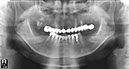%_tempFileNameImplant%2026f1%