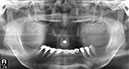 %_tempFileNameImplant%2026f2%