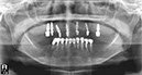 %_tempFileNameImplant%2026f3%