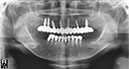 %_tempFileNameImplant%2026f4%