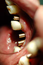 %_tempFileNameImplant%2027a2%
