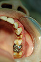 %_tempFileNameImplant%2028a%