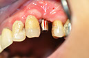 %_tempFileNameImplant%2028b%