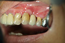%_tempFileNameImplant%2028c1%