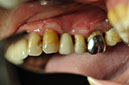 %_tempFileNameImplant%2028c2%