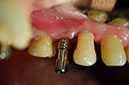 %_tempFileNameImplant%2029b%