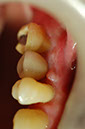 %_tempFileNameImplant%2029c%