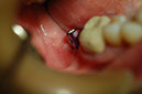 %_tempFileNameImplant%202n%