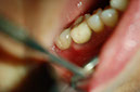 %_tempFileNameImplant%202p1%