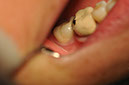 %_tempFileNameImplant%202p5%