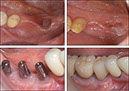 %_tempFileNameImplant%202r1%