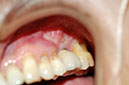 %_tempFileNameImplant%202r2%
