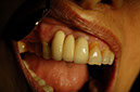 %_tempFileNameImplant%202r3%