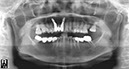 %_tempFileNameImplant%202r4%