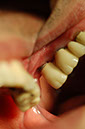 %_tempFileNameImplant%202r6%