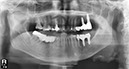 %_tempFileNameImplant%202r8%