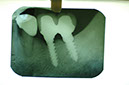 %_tempFileNameImplant%202s2%