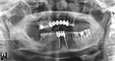 %_tempFileNameImplant%202s3%