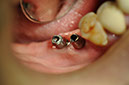 %_tempFileNameImplant%2030b%