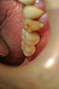 %_tempFileNameImplant%2030c%