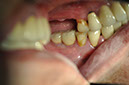 %_tempFileNameImplant%2030e%
