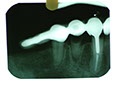 %_tempFileNameImplant%2031c%