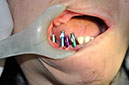 %_tempFileNameImplant%2031g%