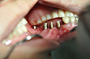 %_tempFileNameImplant%2031h3%
