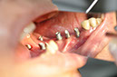 %_tempFileNameImplant%2031h4%