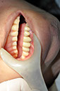 %_tempFileNameImplant%2031i%