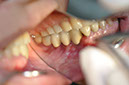 %_tempFileNameImplant%2031j%
