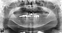 %_tempFileNameImplant%2031k1%